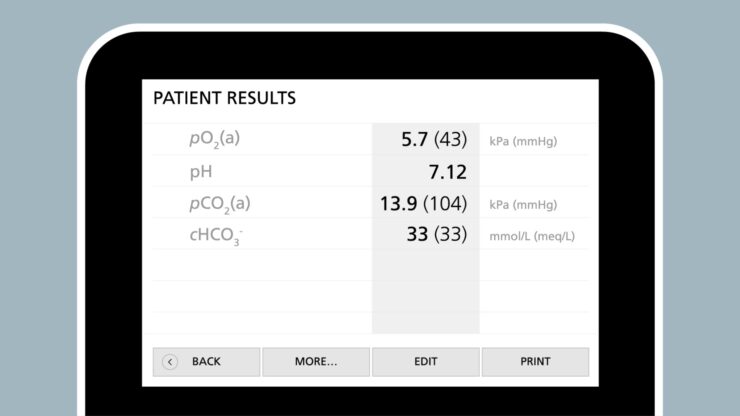 Understanding the acid-base balance